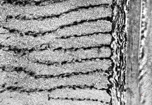 Oxyuris vermicularis - muscular wall